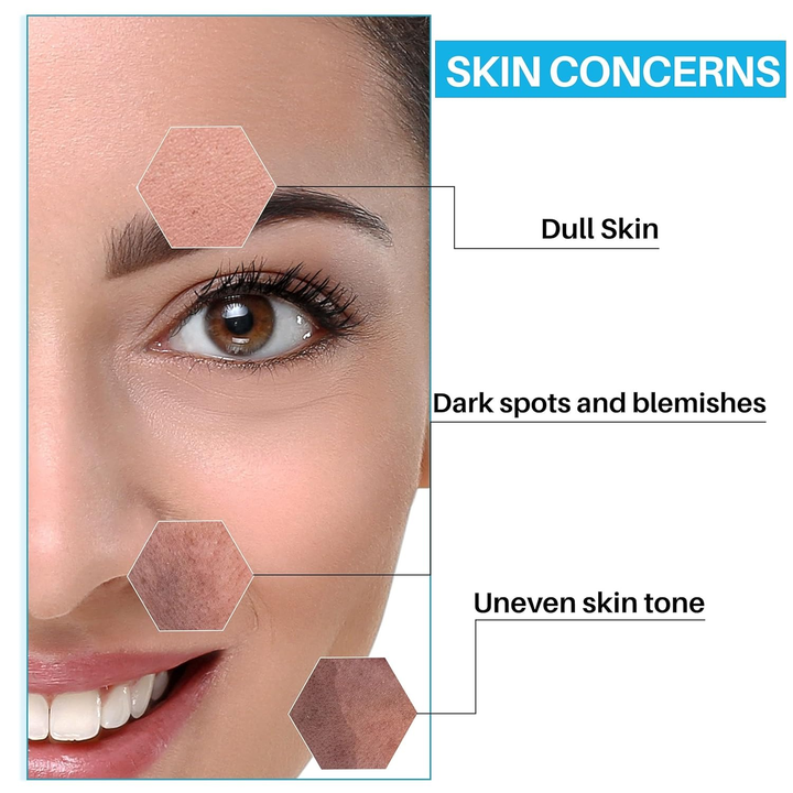 DERMDOC 2% ALPHA ARBUTIN FACE SERUM 15ML