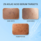 DERMDOC 2% KOJIC ACID FACE SERUM 15ML