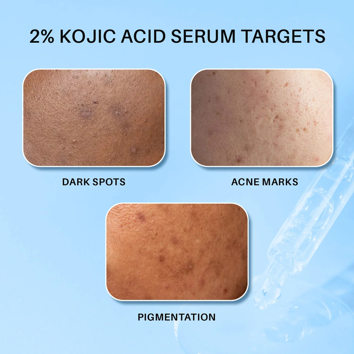 DERMDOC 2% KOJIC ACID FACE SERUM 15ML