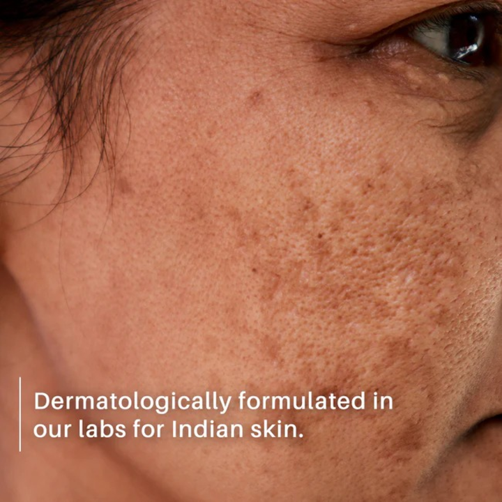 DERMDOC 2% KOJIC ACID FACE SERUM 15ML