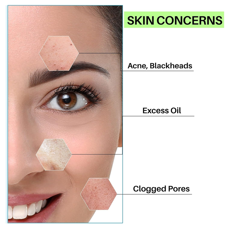 DERMDOC 2% SALICYLIC ACID FACE WASH- 120ML