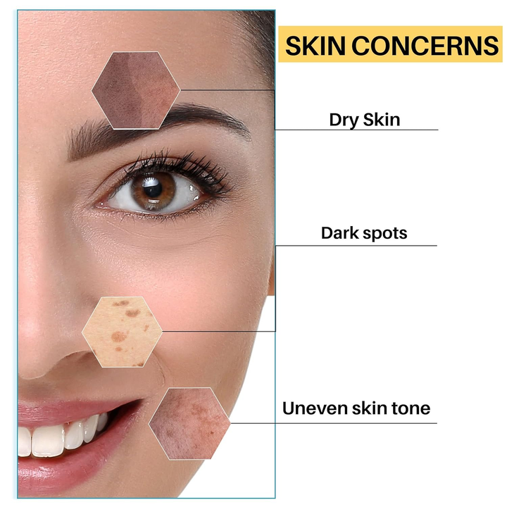 DERMDOC 4% NIACINAMIDE FACE WASH 120ML