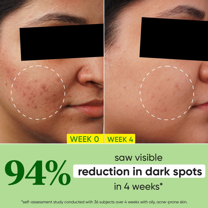 DOT&KEY CICA 10%NIACINAMIDE SPOT REDUCTION FACE SERUM 30ML