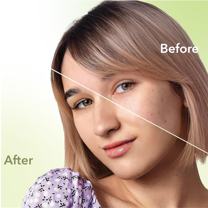 DR. RASHEL ACNE PATCH NEEM- 36N