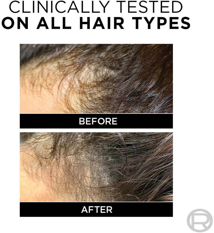 LOREAL FALL RESIST 3X ANTI HAIR FALL SHAMPOO 200ML