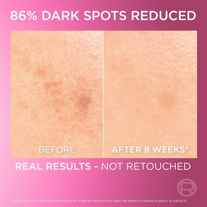 LOREAL PARIS INSTANT GLOWING SERUM 30ML