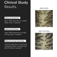 MINIMALIST ANTI DANDRUFF SHAMPOO 3.5% 200 GM