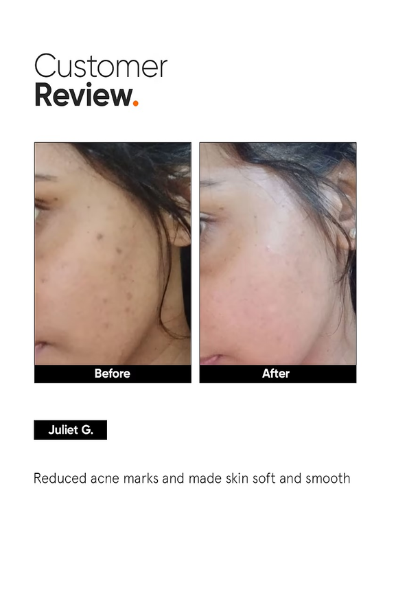 MINIMALIST NIACINAMIDE 5% FACE SERUM 30ML