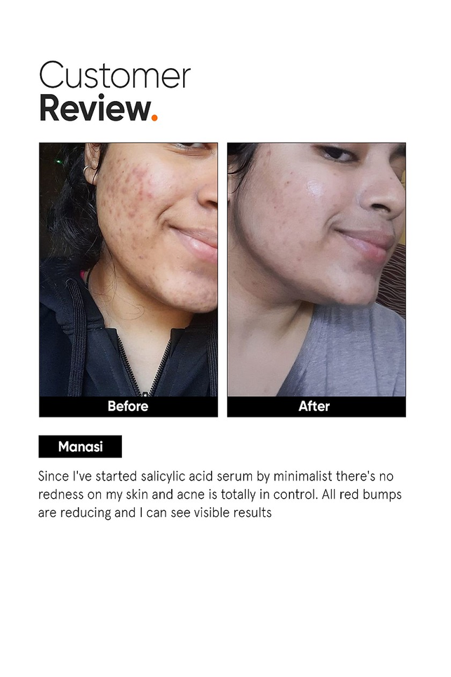 MINIMALIST SALICYLIC ACID 2% SERUM 30ML