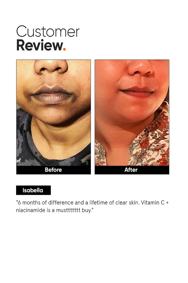 MINIMALIST VITAMIN C+E+FERULIC 16% FACE SERUM- 20 ML