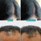 PILGRIM 3% REDENSYL ADVANCED HAIR GROWTH SERUM 30ML