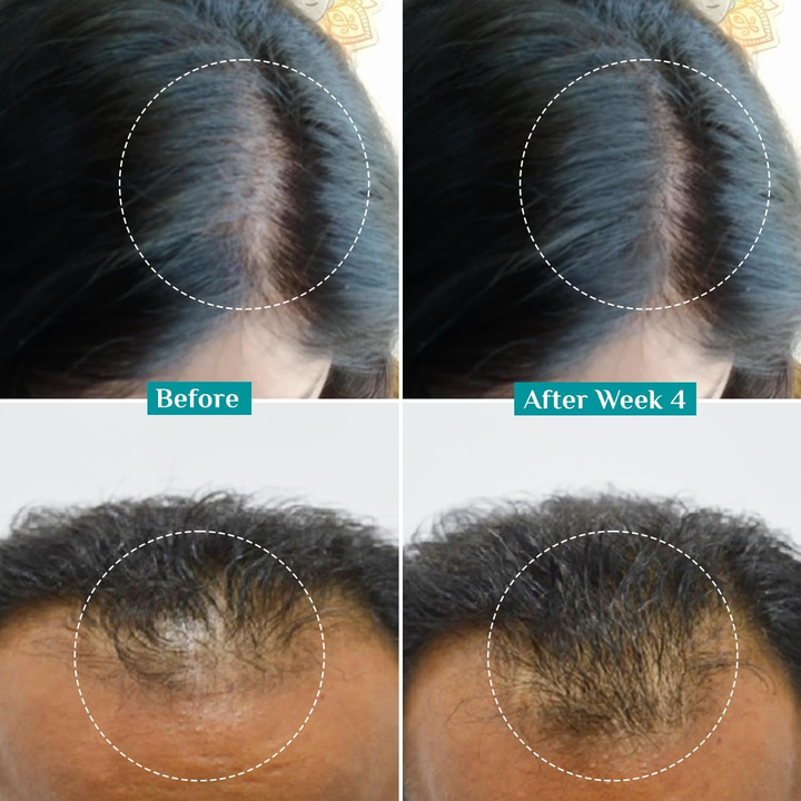 PILGRIM 3% REDENSYL ADVANCED HAIR GROWTH SERUM 30ML