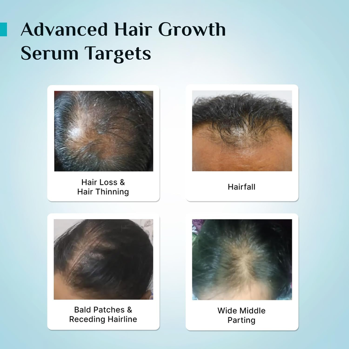 PILGRIM 3% REDENSYL ADVANCED HAIR GROWTH SERUM 30ML