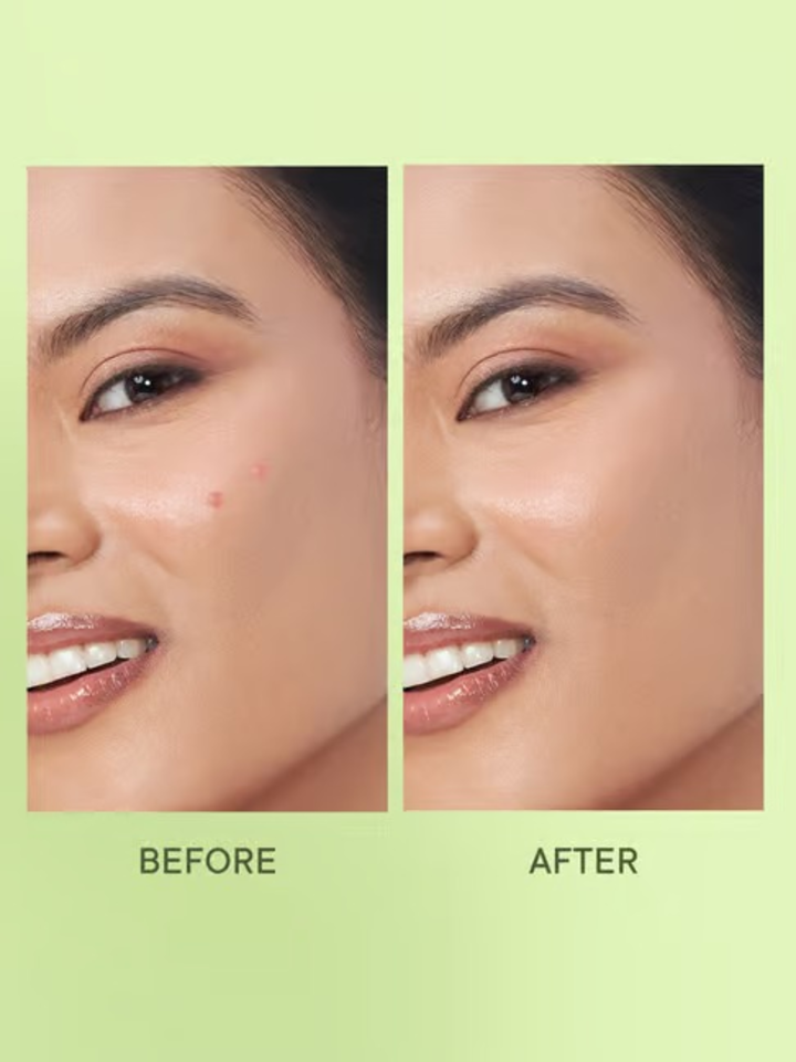 QUENCH MAMA CICA ZIT AWAY TREATMENT PATCHES