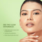 QUENCH CLEAR SKIN SERUM 30ML