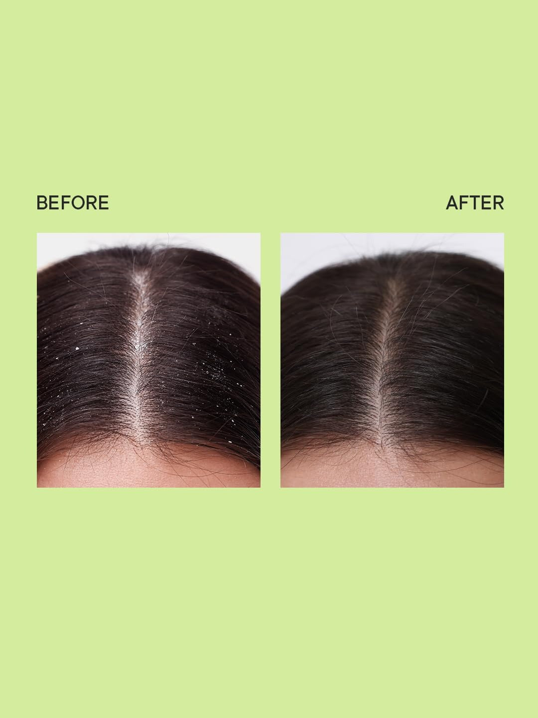 QUENCH DANDRUFF CONTROL AMPULE 100 ML