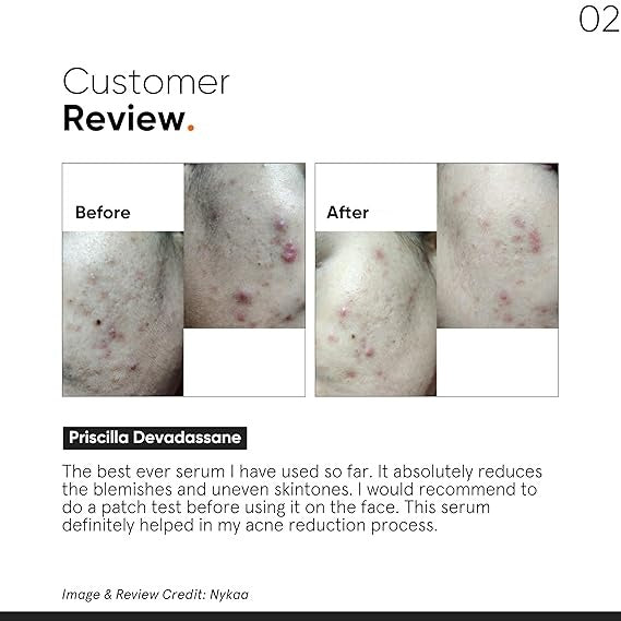 MINIMALIST NIACINAMIDE 10% FACE SERUM + SALICYLIC2% 30ML