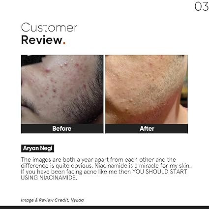 MINIMALIST NIACINAMIDE 10% FACE SERUM + SALICYLIC2% 30ML